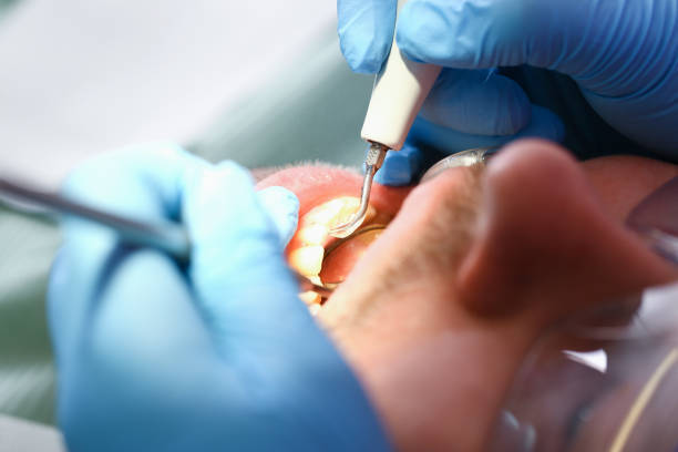 Best Dentist Open Late Near Me  in Zebulon, GA