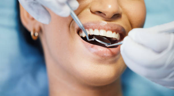 Best Teeth Whitening  in Zebulon, GA