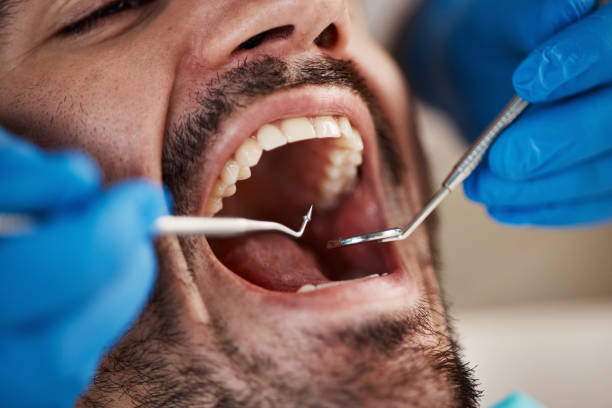 Best Chipped Tooth Repair Near Me  in Zebulon, GA